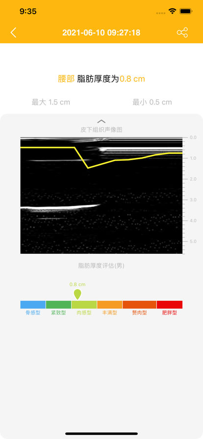 肌脂仪正版下载安装