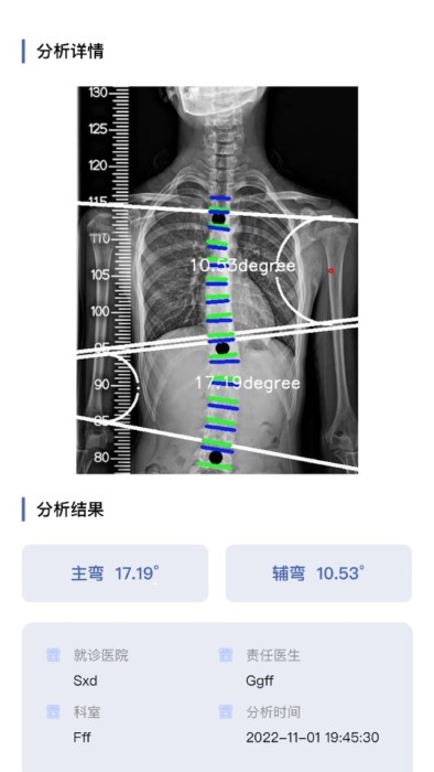 cobb角测量分析平台正版下载安装