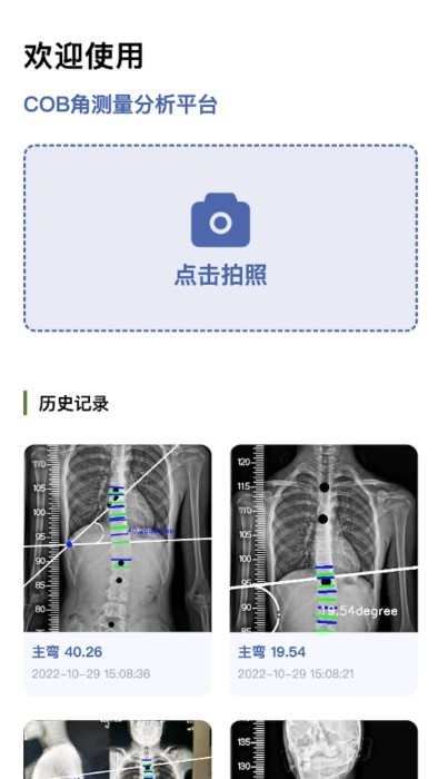 cobb角测量分析平台正版下载安装